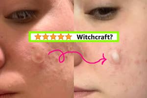 Close-up before and after comparison of facial skin, with text questioning product efficacy and rating stars above