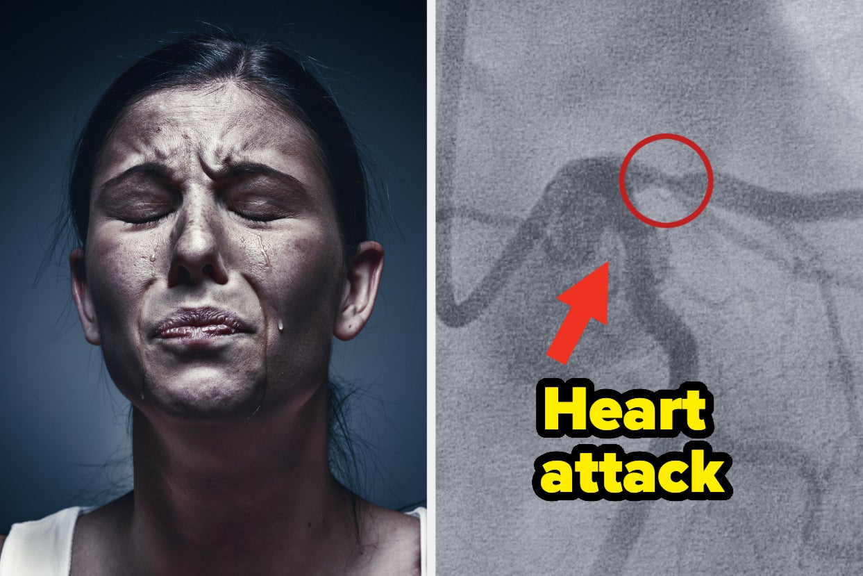 Survivors Describe Their Heart Attack Experience: The Terrifying Signs That Something Was Wrong
