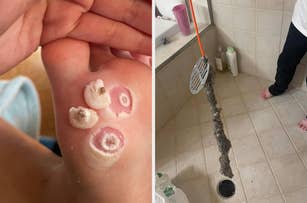 reviewer's warts falling off of feet and reviewer holding drain snake covered in gunk