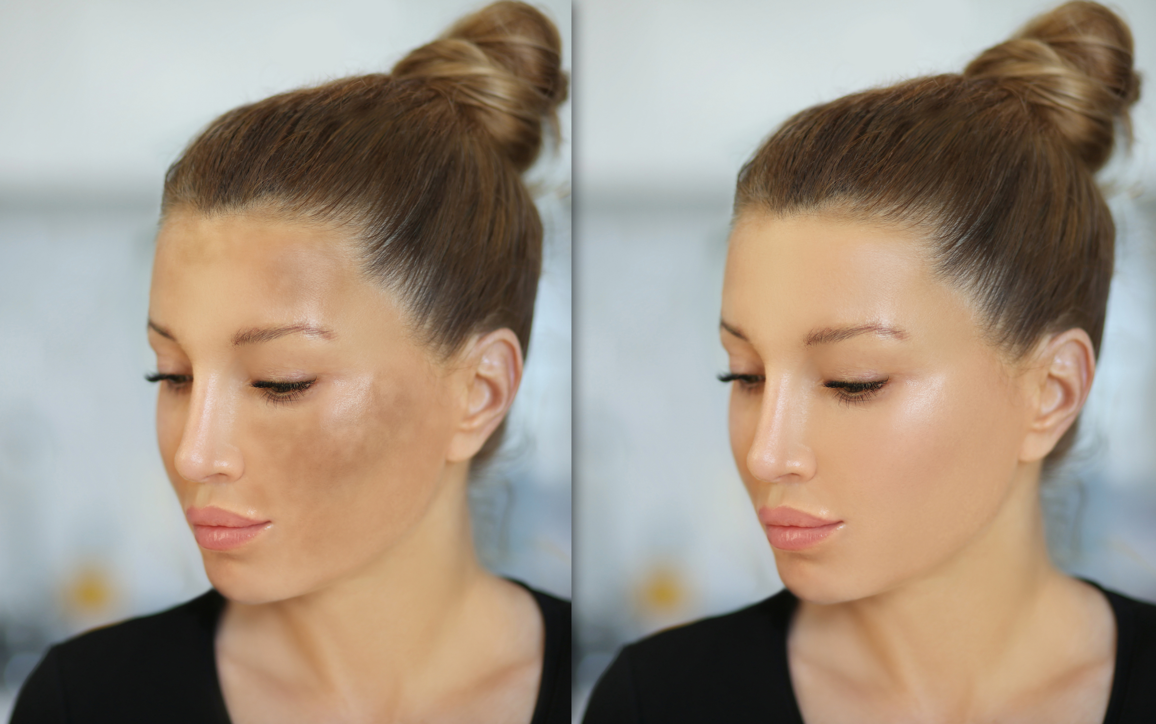 A woman with her hair in a bun shows a skincare comparison: left side with hyperpigmentation, right side with even, clear skin