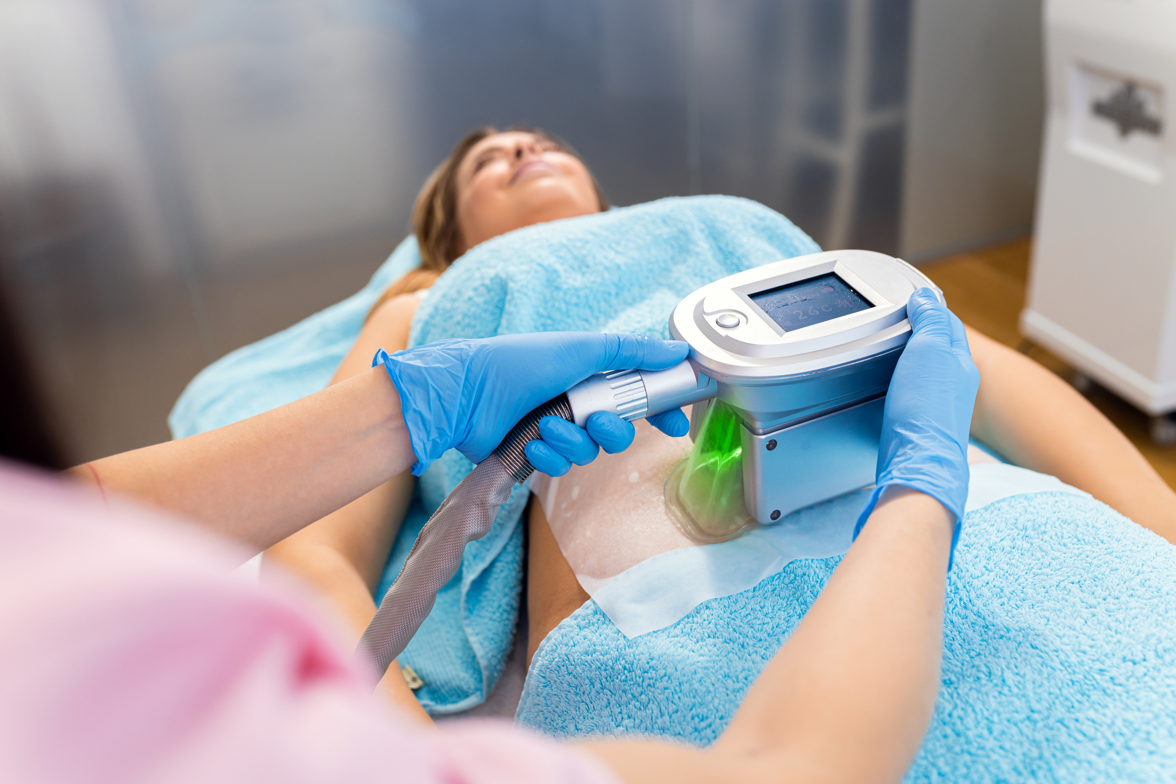 A person receives a cryolipolysis treatment on their stomach. An operator in gloves uses a device with a display. The person is lying down on a treatment bed