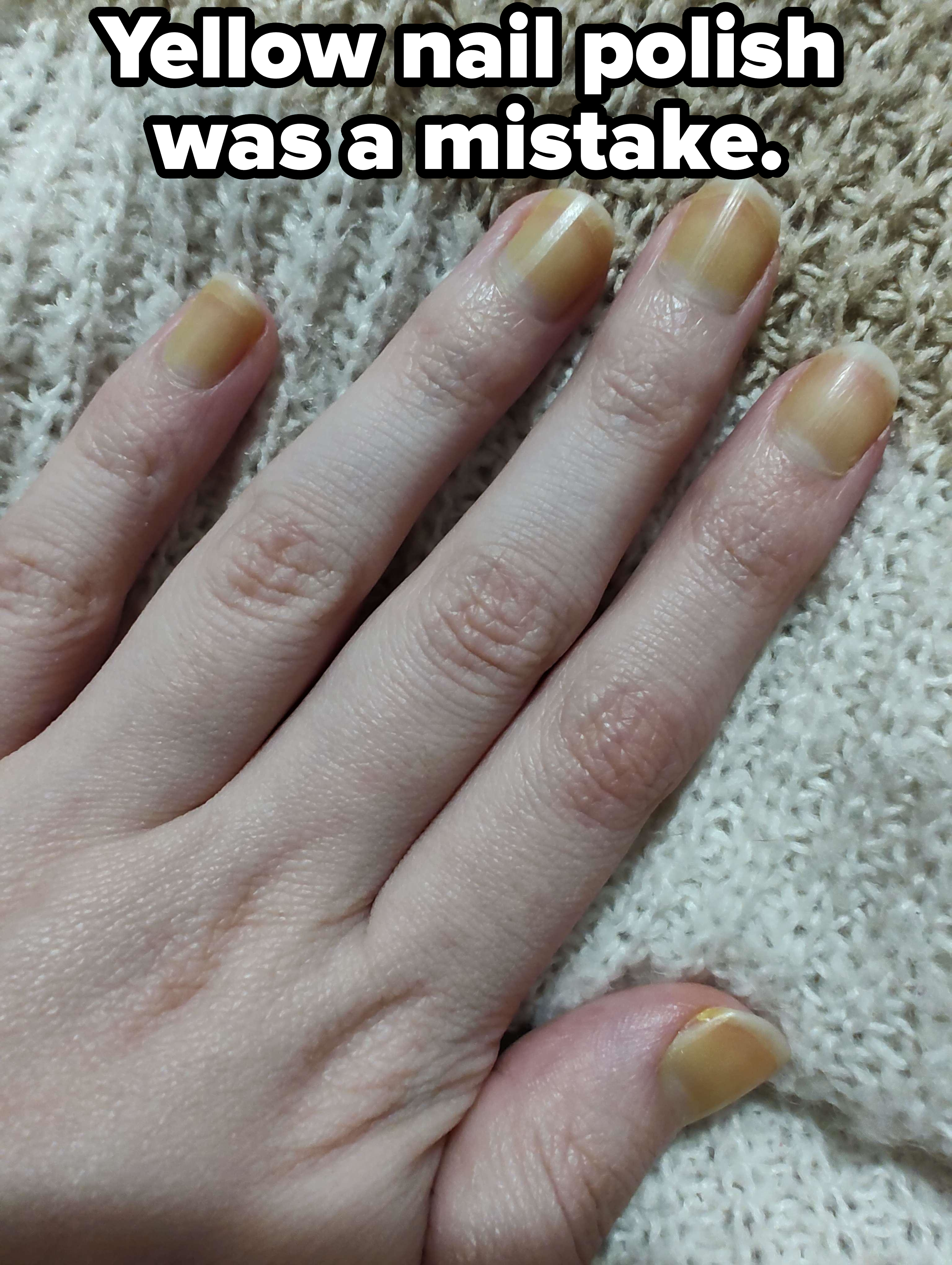 A close-up of a person's hand with yellow-tinted nails, placed on a knitted fabric background. The image shows irregular nail coloration