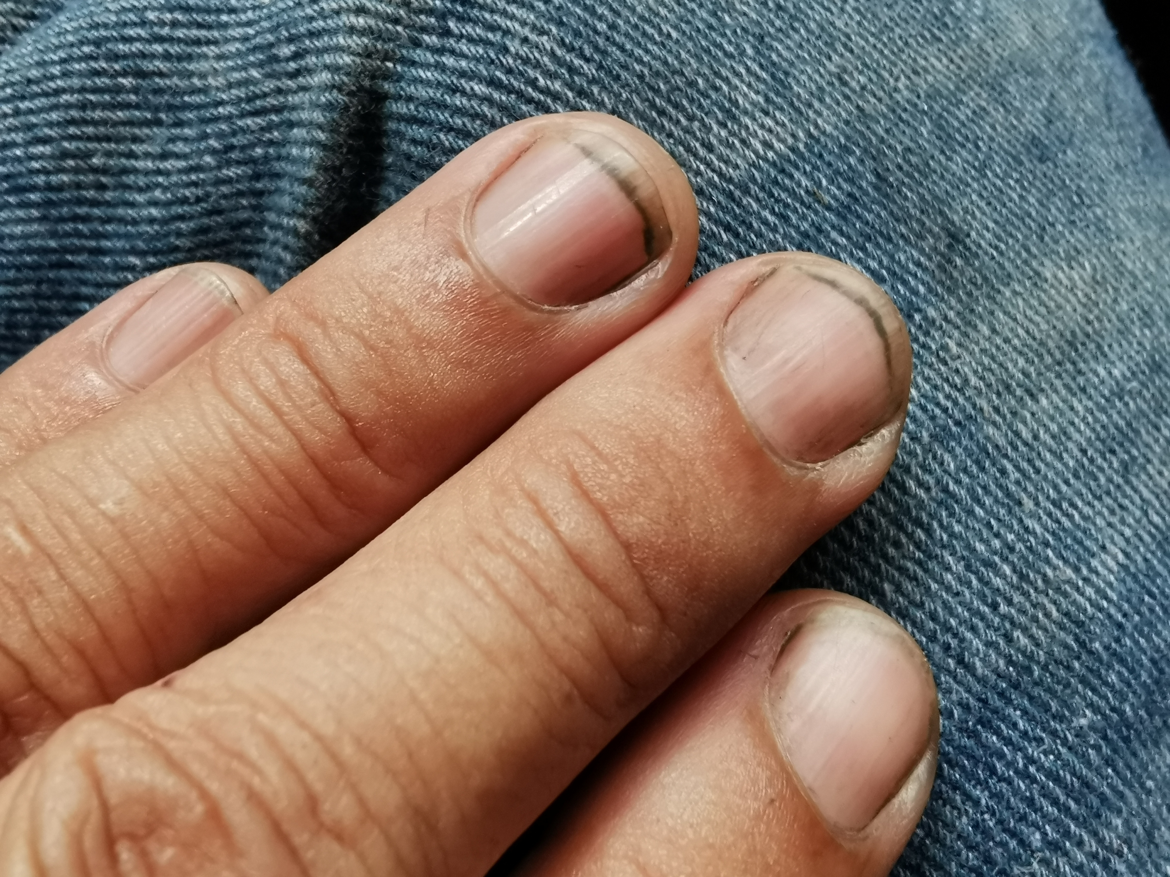 Close-up photo of a hand with dirty fingernails