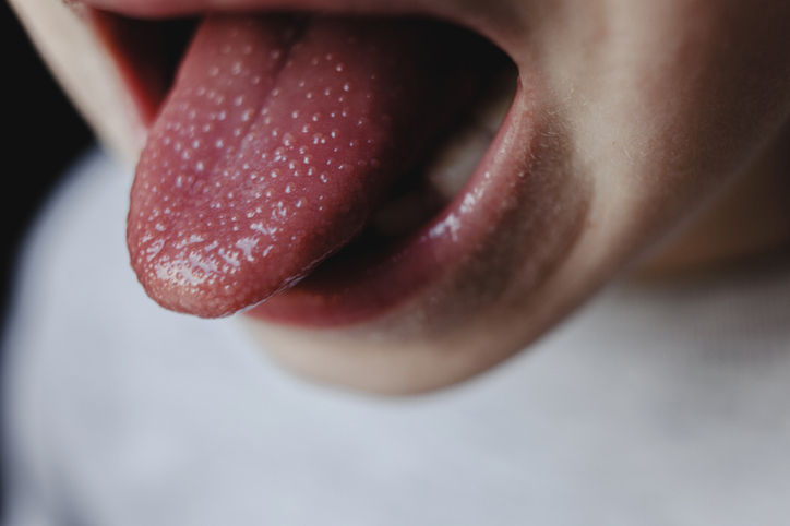 Close-up photo of a child's tongue sticking out