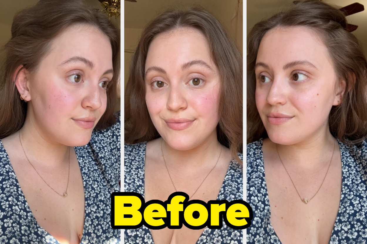 Three side-by-side headshots of a woman labeled "Before," showing her natural, unaltered beauty. She wears a patterned top and a delicate necklace