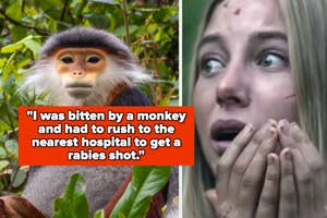 "I was bitten by a monkey and had to rush to the nearest hospital to get a rabies shot" over a monkey and a gasping woman