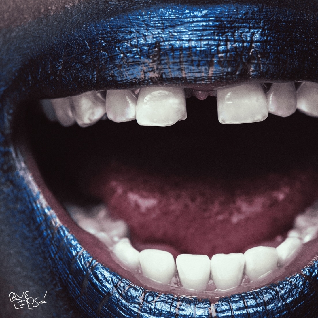 Close-up photo of an open mouth with metallic blue lipstick and a gap between the front teeth. The words &quot;BLUE LIPS!&quot; are handwritten in the corner