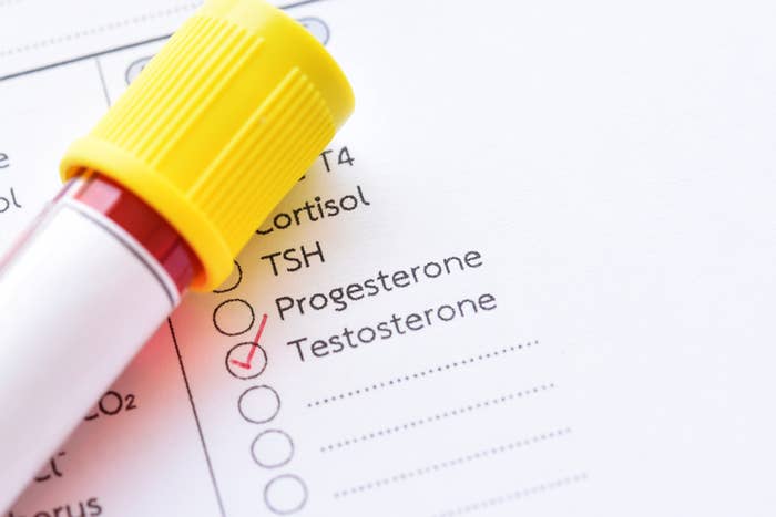 A medical test form with a check mark next to "Testosterone" and a blood sample collection tube placed on top of the form