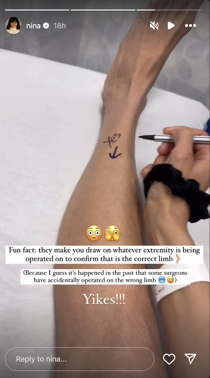 Nina writes &quot;yes&quot; and an arrow on their leg to mark the correct limb for surgery. Text humorously notes this precaution to avoid operating on the wrong limb