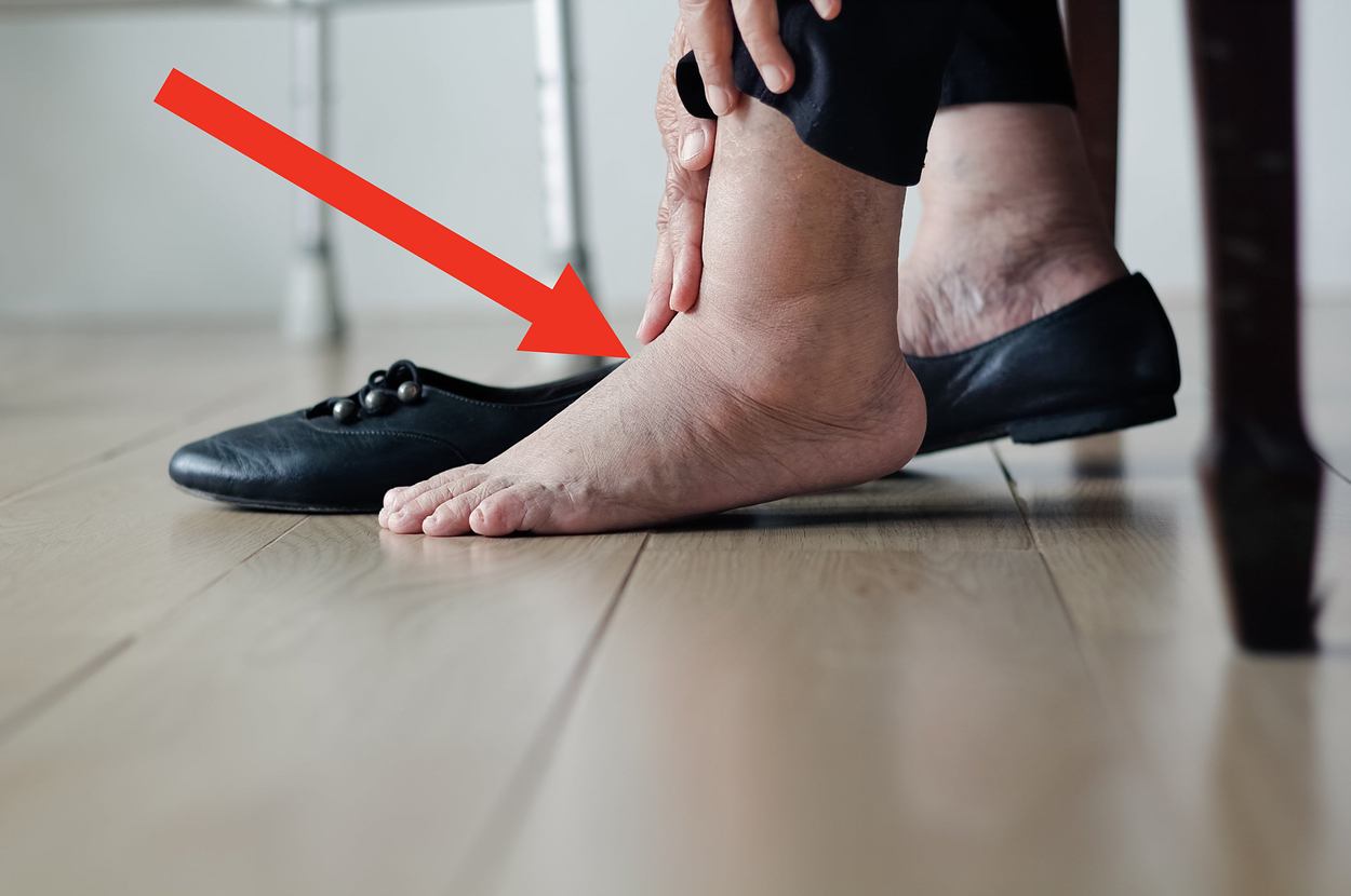 A person is holding their swollen ankle and foot, with one black flat shoe on the floor beside them. The person is seated and appears to be in discomfort