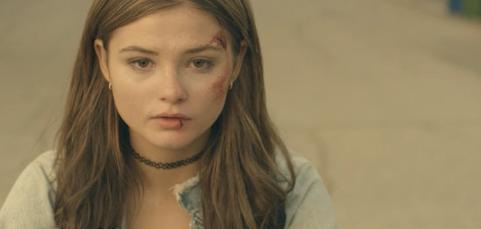 Actress in casual attire with noticeable facial scratches and a choker necklace, looking solemn
