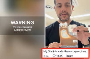 A man in a black shirt holds a medical stool sample bag, with the text overlay reading, "My GI clinic calls them crapaccinos."