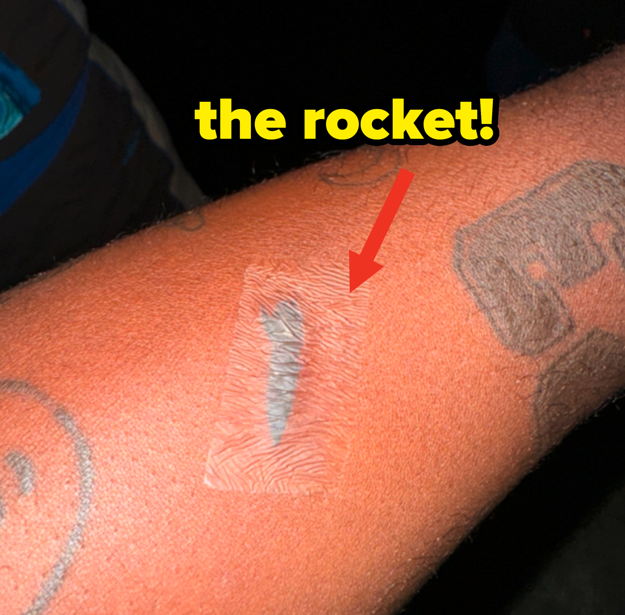 Close-up of a Mychal's arm with a small bandage covering a wound, surrounded by tattoos