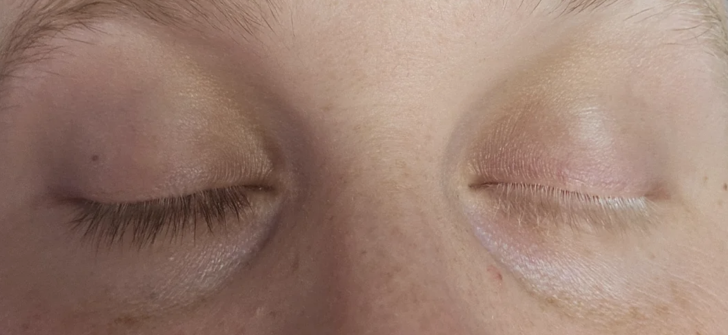 A close-up image of a person's closed eyes, showing their eyelashes and the skin around their eyes