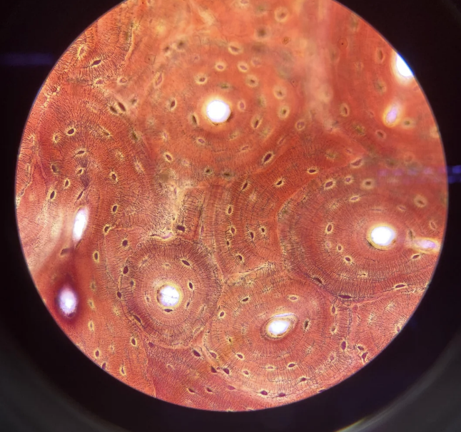 Microscopic view of human bone tissue showing osteons and Haversian canals