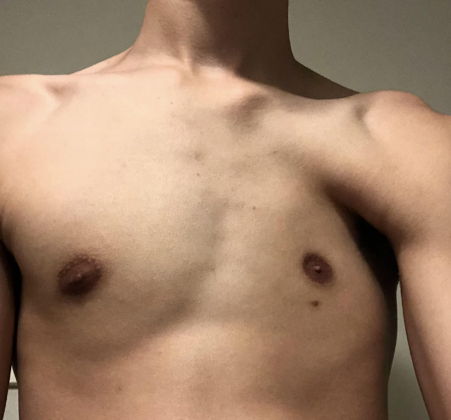 Topless person is shown from the neck to the waist, with visible chest and shoulders. Their face is not visible in the image