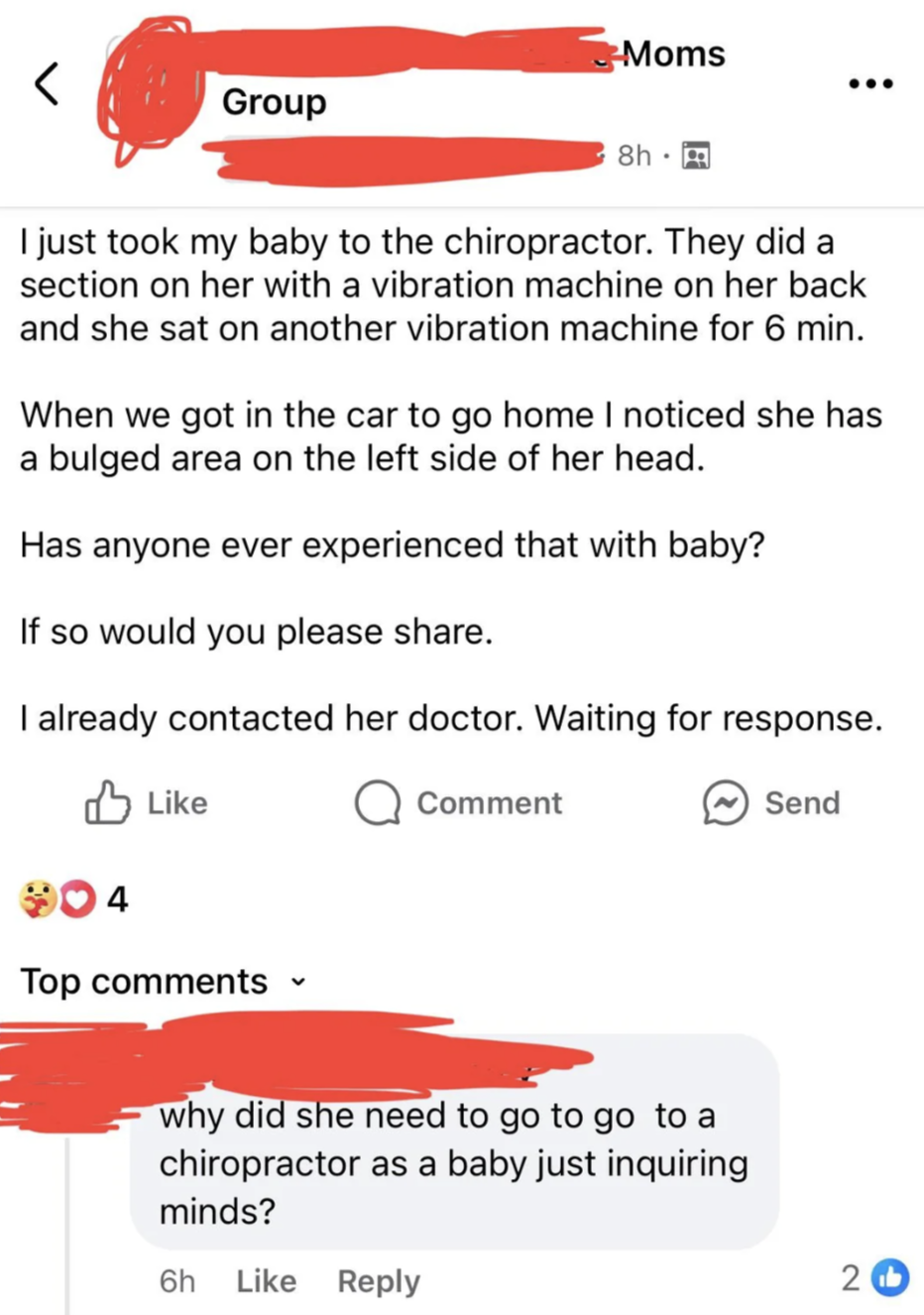 Facebook post in a Moms Group: A mother shares her baby's chiropractic experience and mentions noticing her baby has a bulged area on the left side of her head, asking for advice