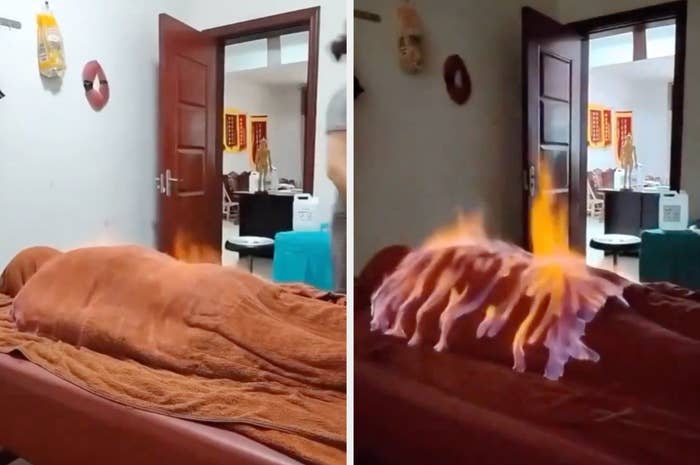 A person lies face down on a table covered with a brown towel while small flames burn on their back in a spa-like room