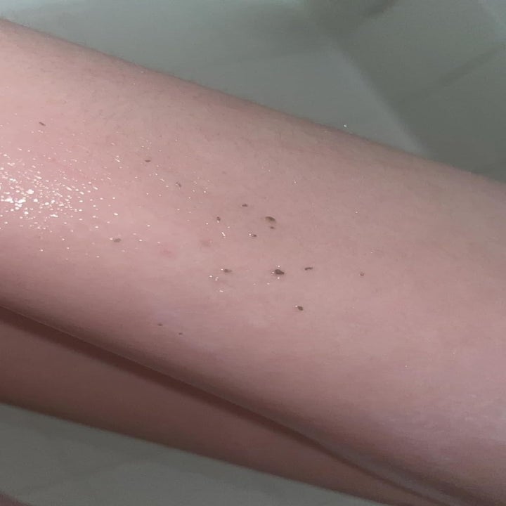 buildup from a reviewer's pores