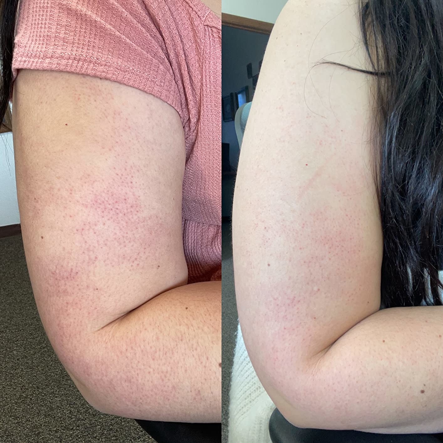 a split reviewer photo of their arm before and after using the body scrub