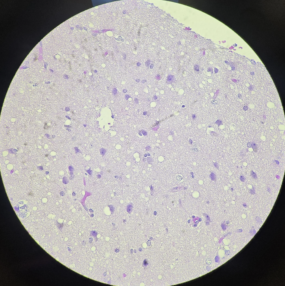 Microscopic view of brain tissue displaying various cell types and structures