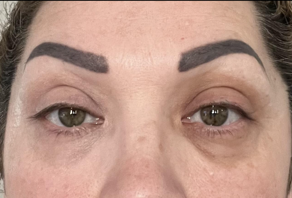 Close-up of a person with eye brightener on their left eye and without it on the right