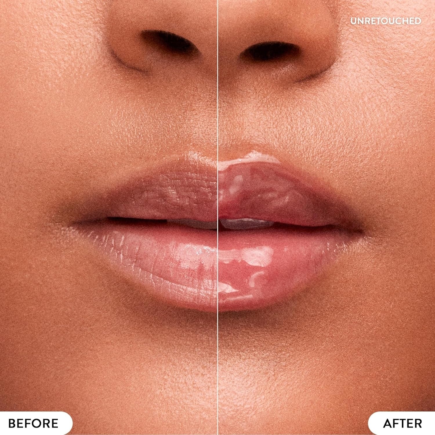 Close-up of person's lips with a side-by-side examination  labeled 