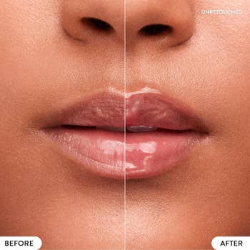 Close-up of person's lips with a side-by-side examination labeled