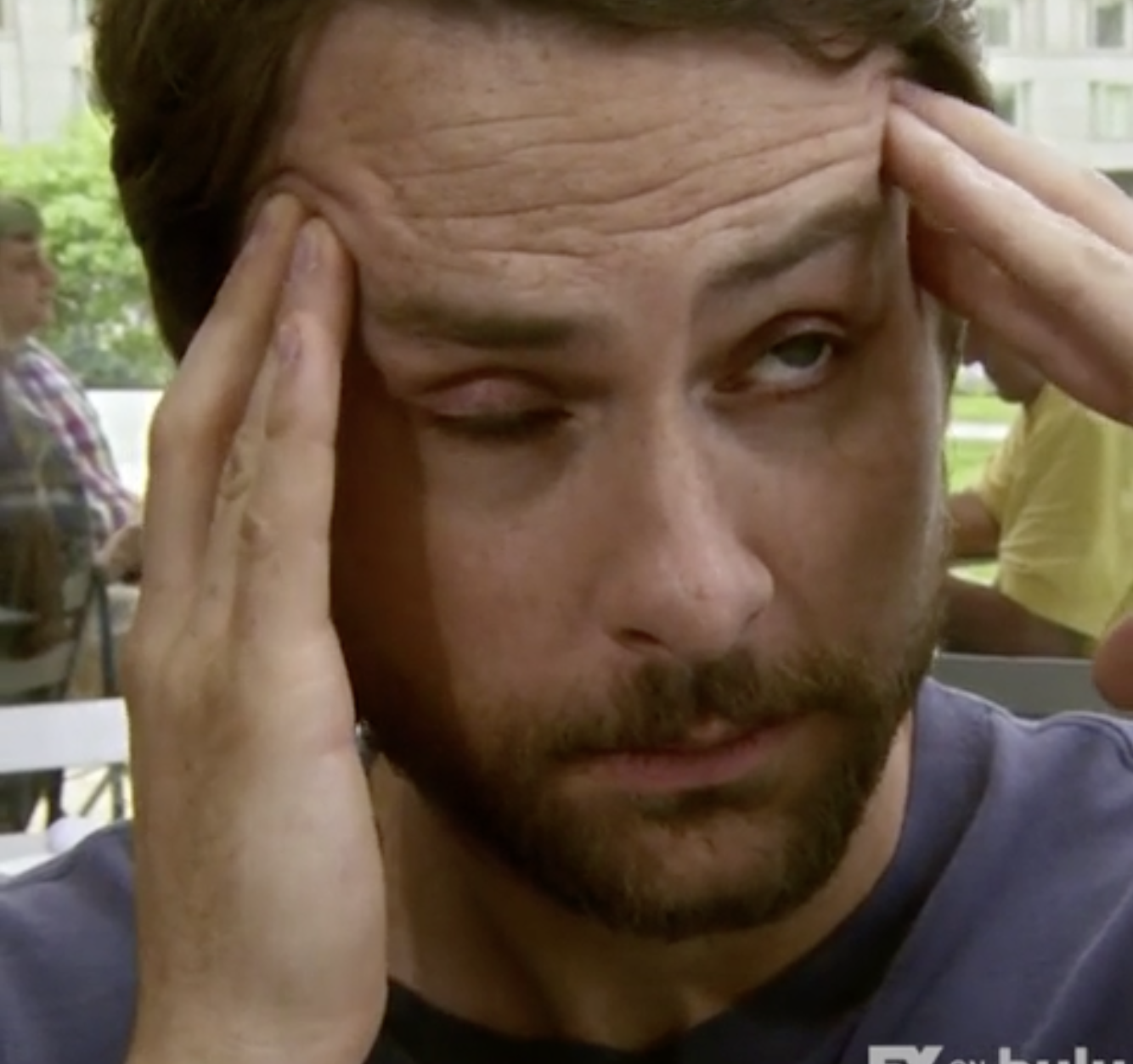 Charlie Day, holding his temples with both hands, appears stressed