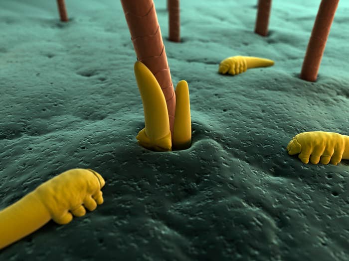 Close-up of yellow Demodex mites at the base of human hair follicles under a microscope