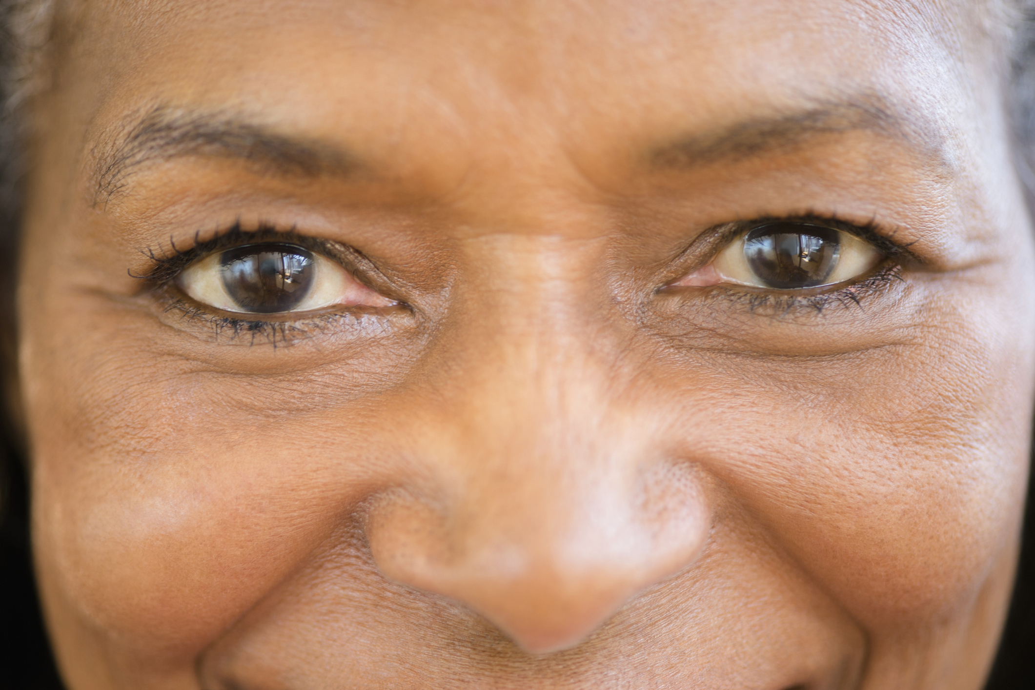 Close-up of a smiling person’s eyes and nose, focusing on the wrinkles and textures of the skin. The person is unknown