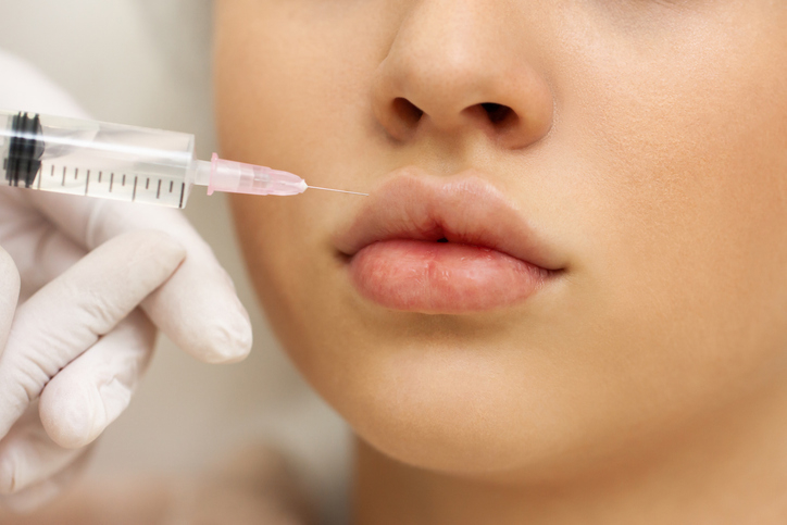 A close-up of a person's lips as they receive a cosmetic injection with a syringe, administered by a gloved hand