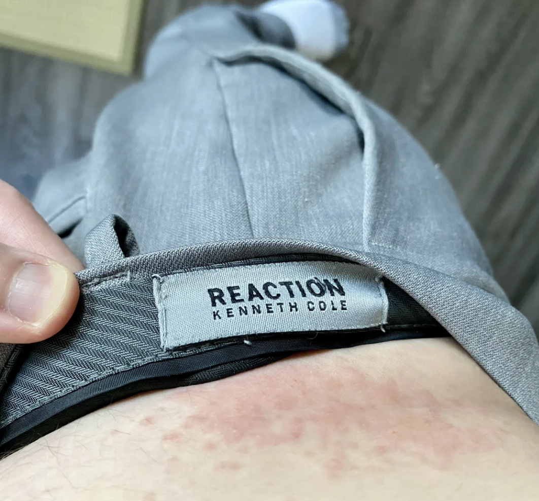 Close-up view of a Kenneth Cole Reaction label on a pair of pants being worn, showing part of the waistband and a patch of irritated skin