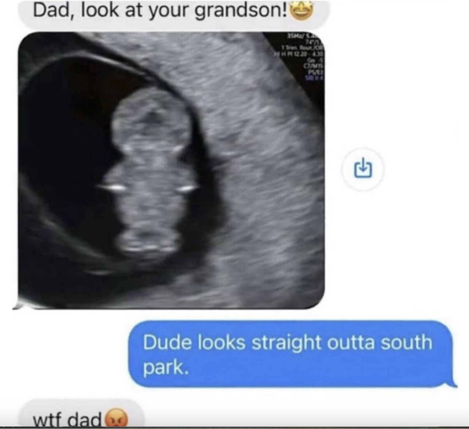 Ultrasound image of a fetus. Texts read: "Dad, look at your grandson!" Reply: "Dude looks straight outta South Park." Final text: "wtf dad."