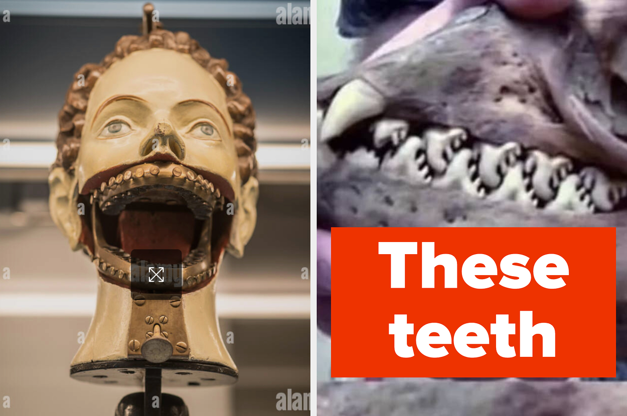 Split image featuring a mechanical figure with an open mouth, showing gears on the left, and a close-up of sharp, jagged teeth on the right with the text "These teeth."