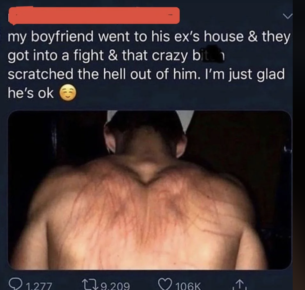Tweet showing the back of a shirtless person with multiple scratch marks. Text: "my boyfriend went to his ex’s house & they got into a fight & that crazy bit*h scratched the hell out of him. I’m just glad he’s ok ?"