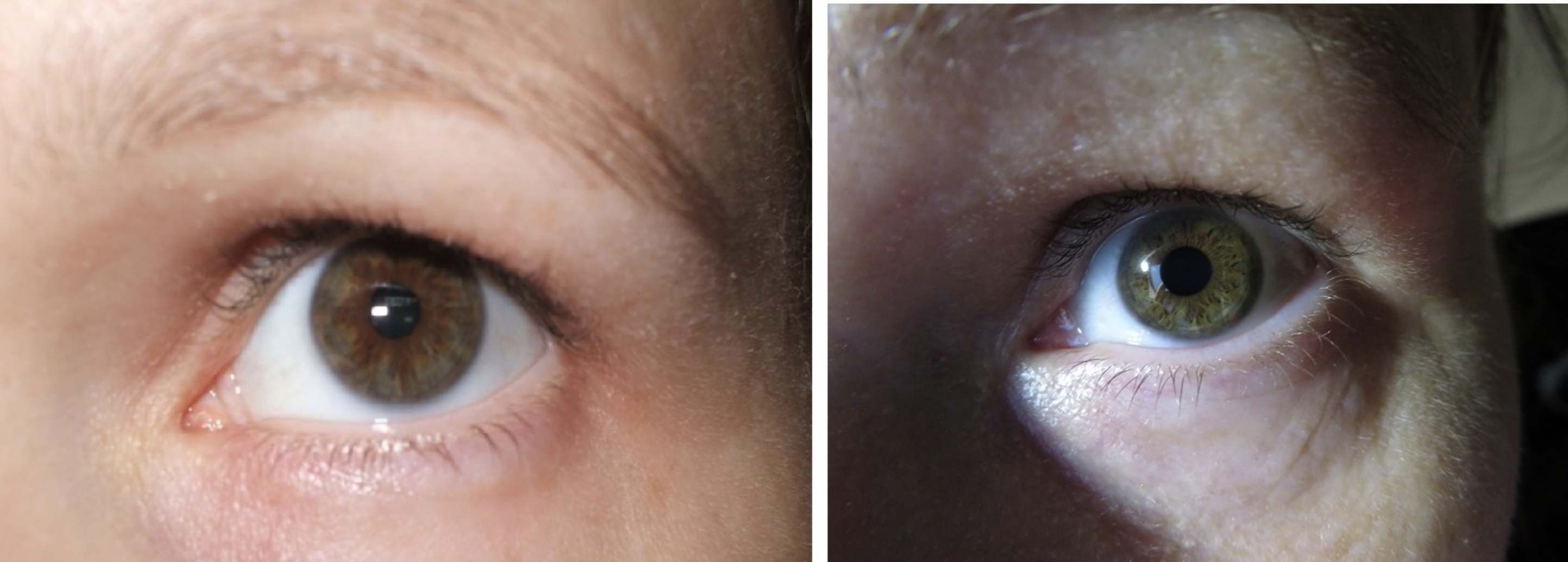 A close-up of two human eyes, side by side, showing detailed iris patterns and skin textures around the eyes