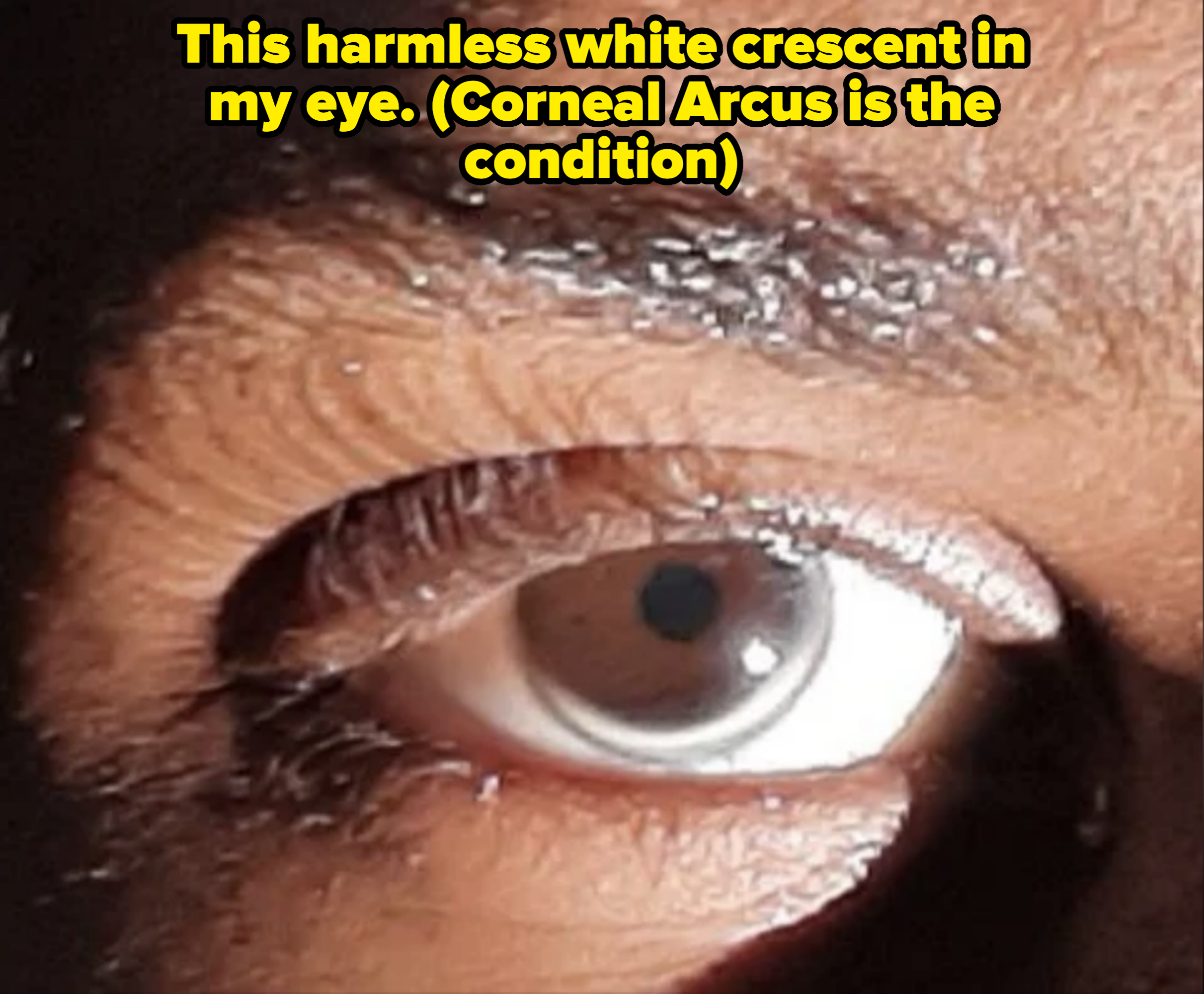 Close-up of a person's eye, showing detail in the iris, eyelashes, and surrounding skin texture. No other notable elements or context available