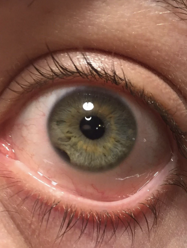 Close-up of a human eye with visible greenish iris, eyelashes, and tear ducts