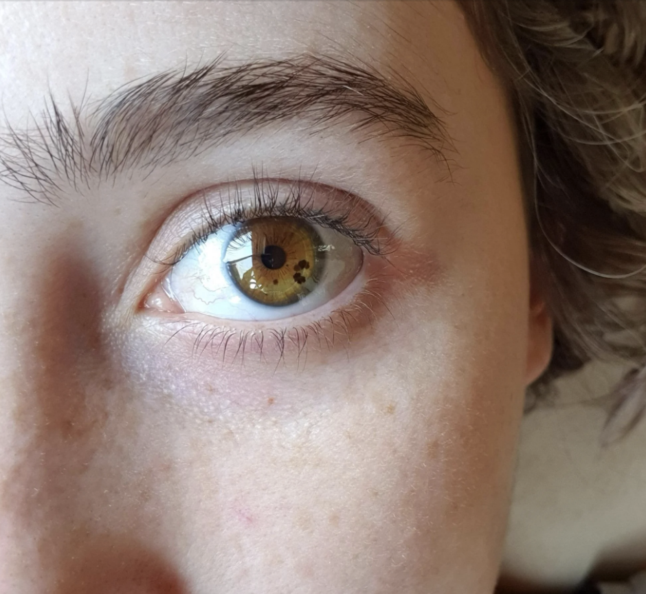Close-up of a person's eye with light brown iris, visible eyebrow, and a few freckles. No names available