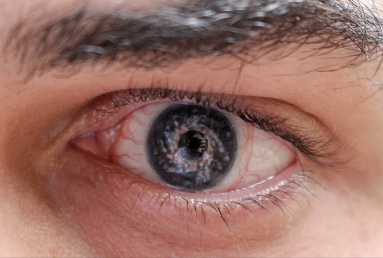 Close-up image of a human eye with visible eyelashes and veins. The iris has a reflective pattern, resembling a galaxy or night sky