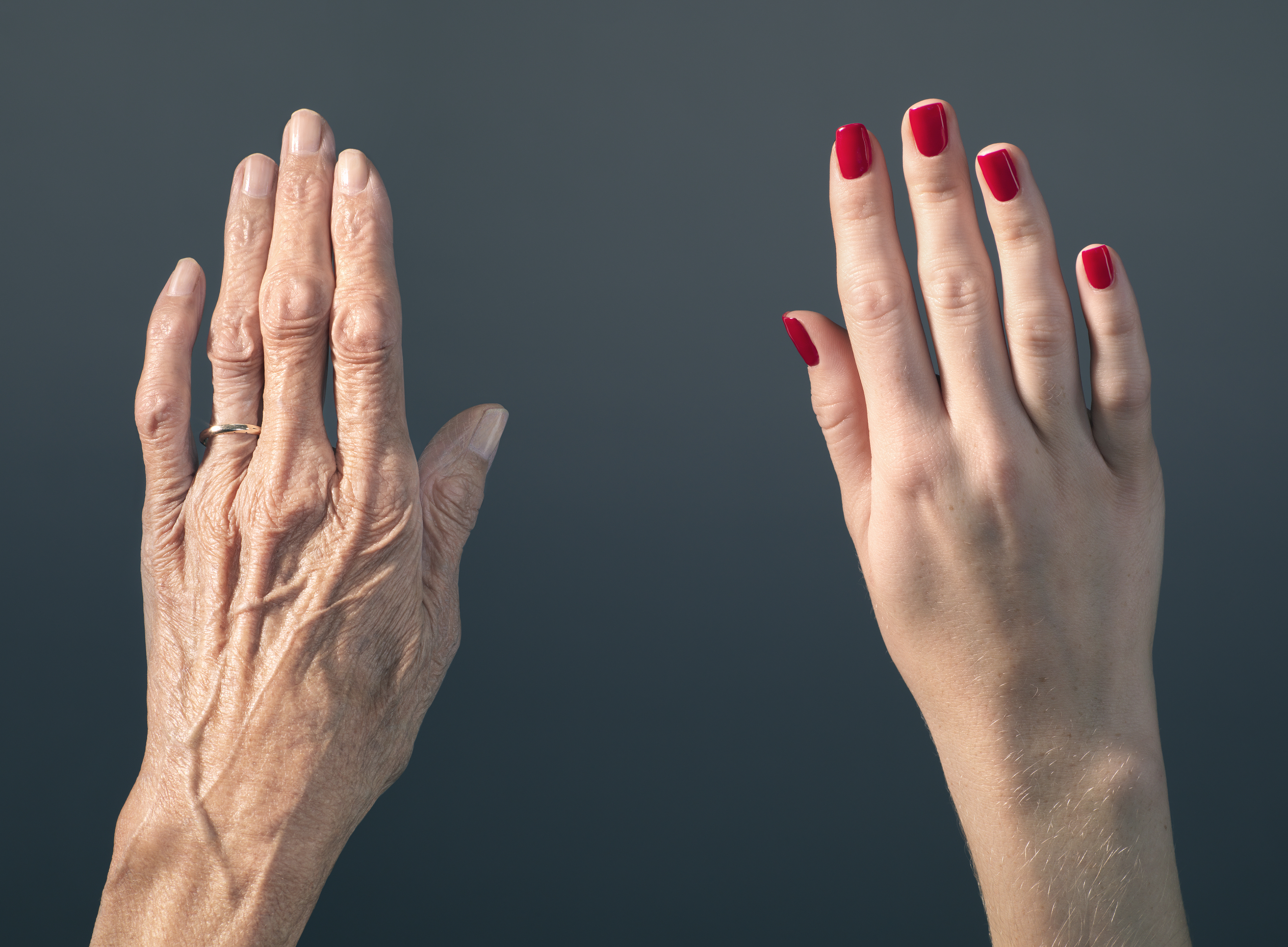 One older hand with wrinkles and a wedding ring is next to a younger hand with smooth skin and red nail polish.