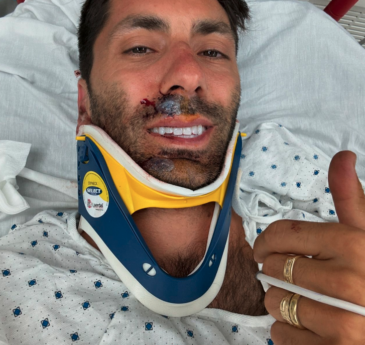 Nev Schulman in a hospital bed wearing a neck brace, giving a thumbs up, and smiling despite some visible facial injuries