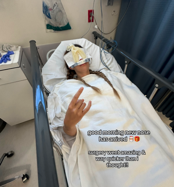 Sami is in a hospital bed post-surgery with a bandaged nose, giving a hand gesture. Text on the image reads: &quot;good morning new nose has arrived ?? surgery went amazing &amp;amp; way quicker than I thought!!!&quot;