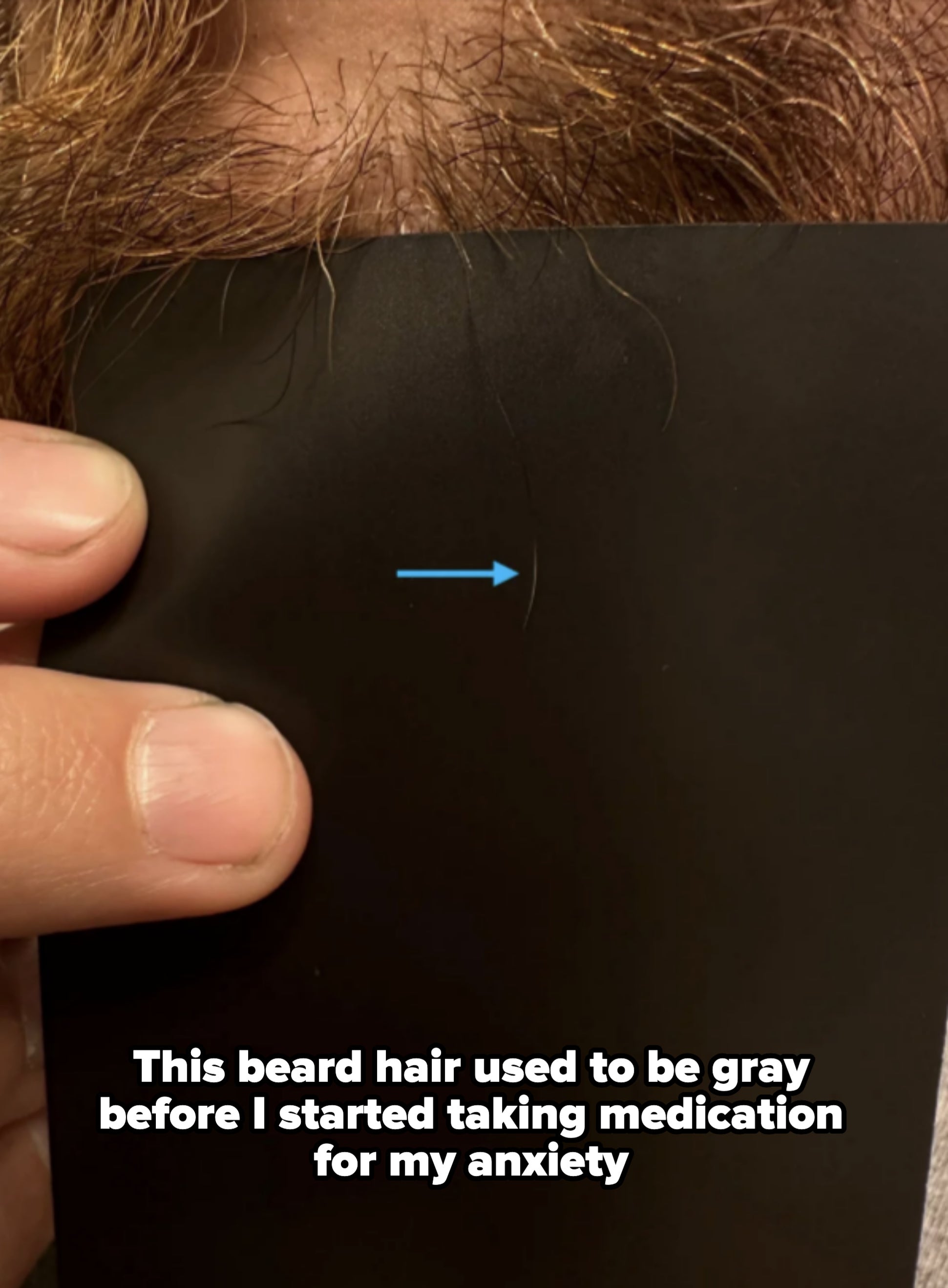 A hand holding a black card with a blue arrow pointing at a thin hair sticking out from above the card