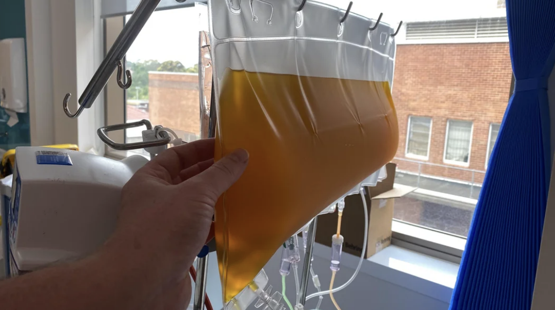 A person holds up a large bag of yellow liquid in a medical setting, possibly plasma, near a window. No other people are visible