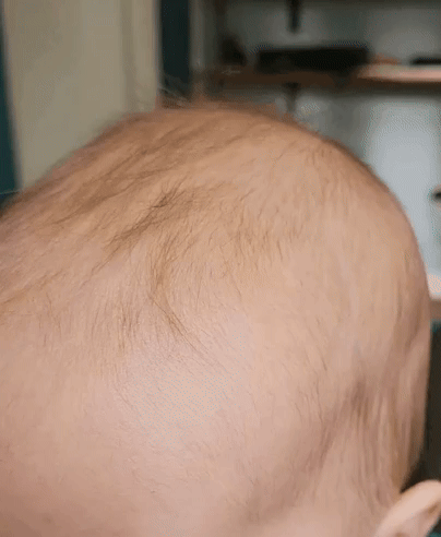 Close-up of a baby with thin hair, wearing a green top. The baby is looking downward with eyes nearly closed