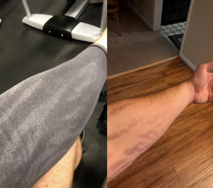 Two close-up photos of a person's arm showing the difference in perspiration pattern on clothing material in a gym setting and at home