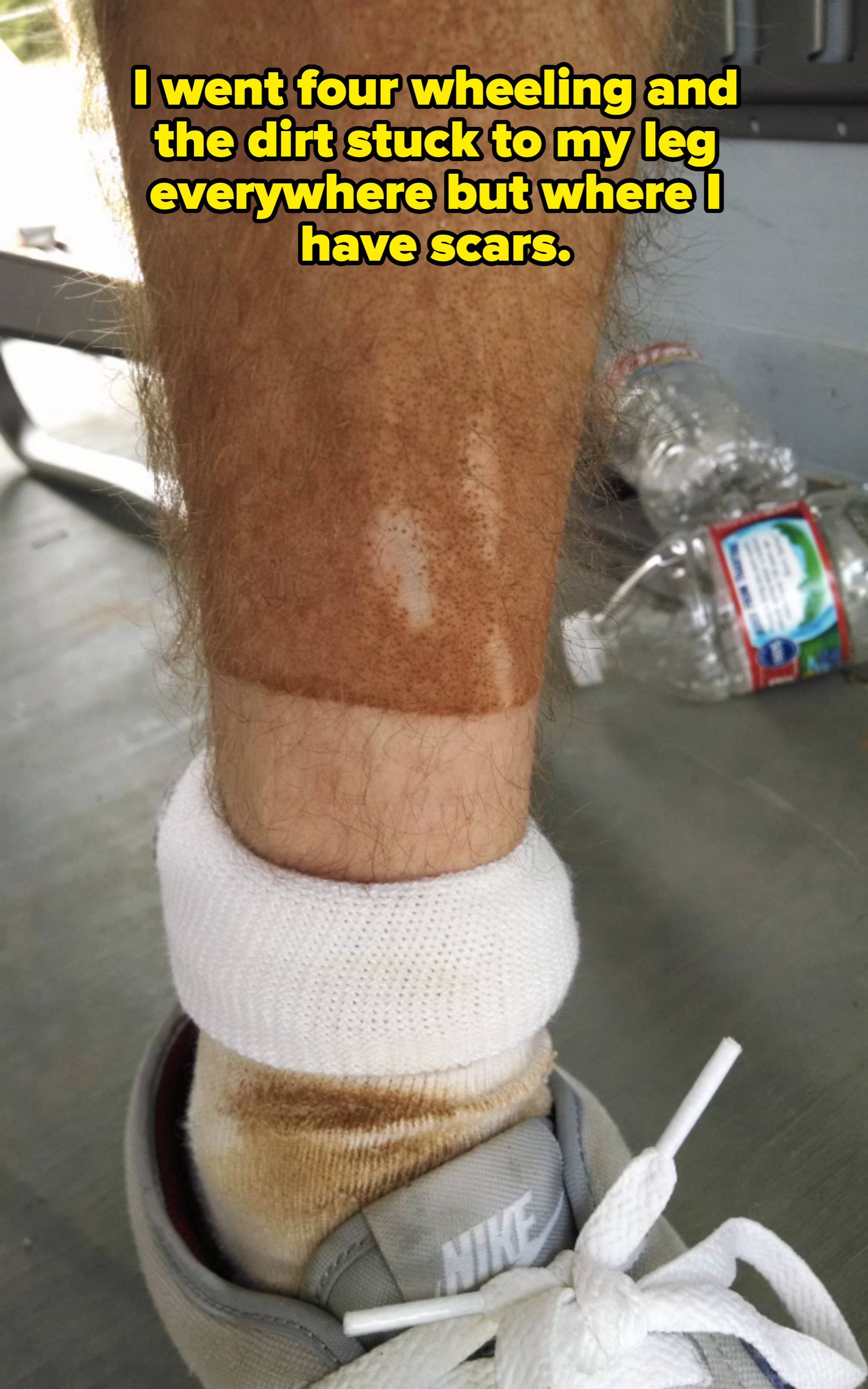 A person's lower leg with a distinct tan line above their sock. A discarded bottle of water and other items are in the background