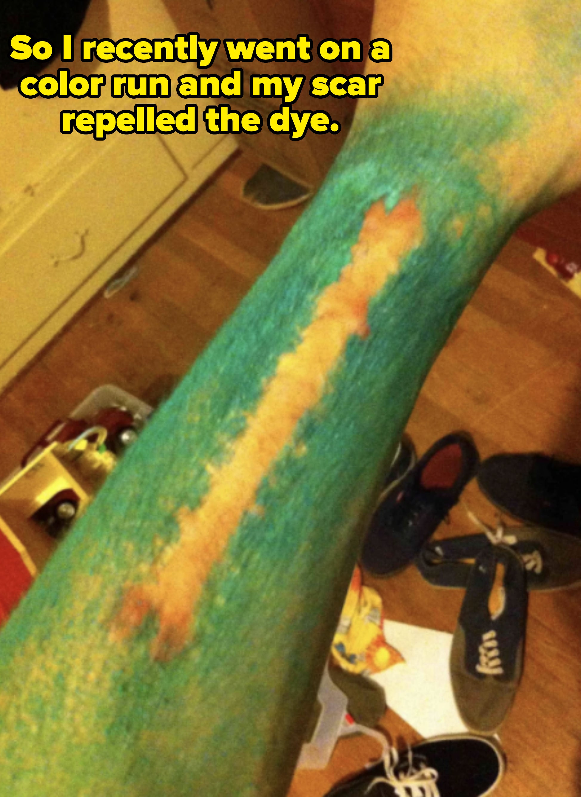 An arm with a reddish scar that extends along the forearm, surrounded by green paint. The background is a room with scattered shoes and boxes
